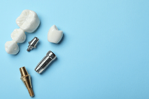 parts of dental implants representing cost of dental implants in Rockville