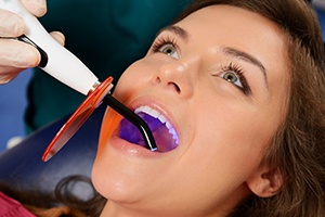 Hand holding UV light to woman’s tooth to complete direct bonding procedure