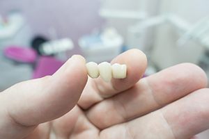 lab technician with dental bridge in Rockville