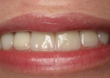 Closeup of healthy attractive smile