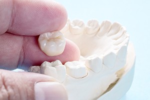 Rockville dentist holding a dental crown above a model jaw