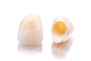 Closeup of dental crowns in Rockville on white background