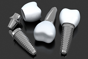three dental implant posts with crowns and abutments