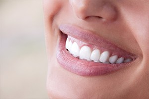 Closeup of healthy smile