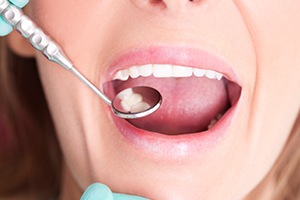 Woman receiving dental checkup