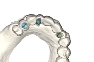 scan of patient’s teeth
