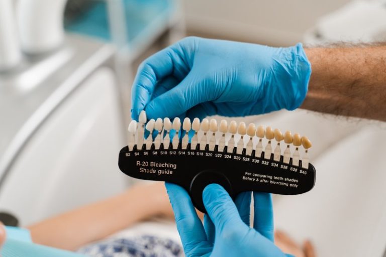 Dental Crown Shade Guide Dr. Robert J. Sanker